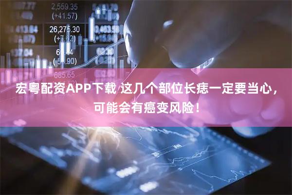 宏粤配资APP下载 这几个部位长痣一定要当心，可能会有癌变风险！